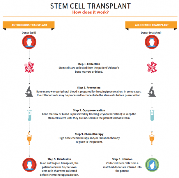 Understanding Stem Cell Transplant - Vanderbilt-Ingram Cancer Center